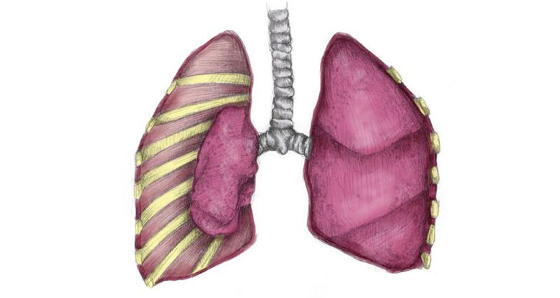 肺功能衰竭,